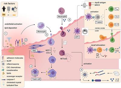 Immune Mechanisms of Plaque Instability